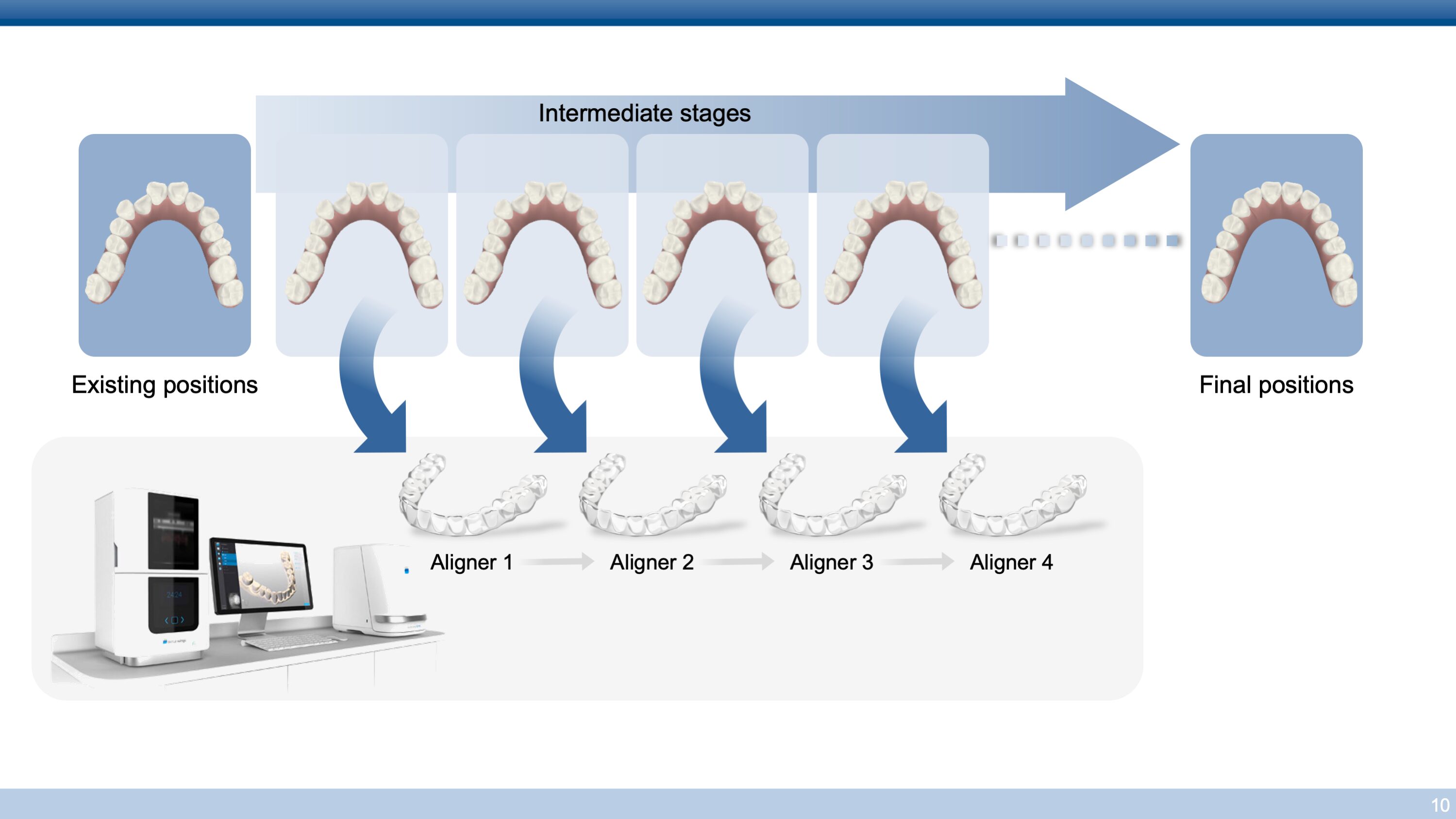 Intermediate stages of teeth and different aligners used